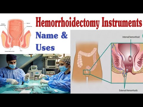 Video: Instrumente folosite în hemoroidectomie?