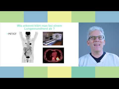 Video: Verkalktes Granulom: In Der Lunge, Behandlung, Mehr