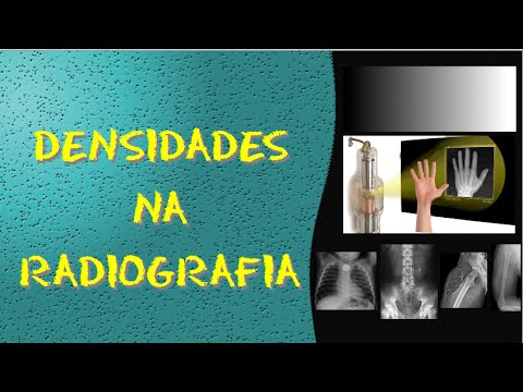 Videoaula e dicas de Radiologia e Diagnóstico por imagem - Radiografia - Densidades radiográficas