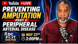 Amputation Prevention, Part 2: Peripheral Arterial Disease