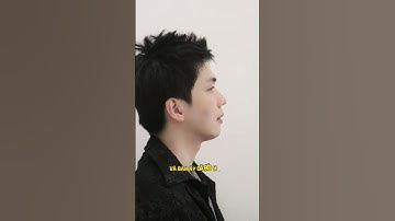 Lột xác sau 2 năm niềng răng hô - Bác sĩ phân tích kế hoạch điều trị