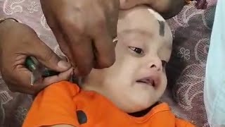 Ear piericing for baby kid with gold kondlu