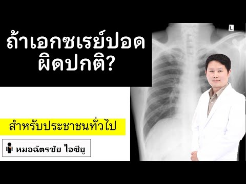 วีดีโอ: ให้อะไรใน xray?