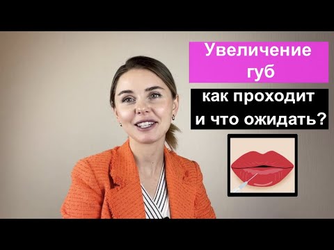 Увеличение губ: как проходит и что ожидать?