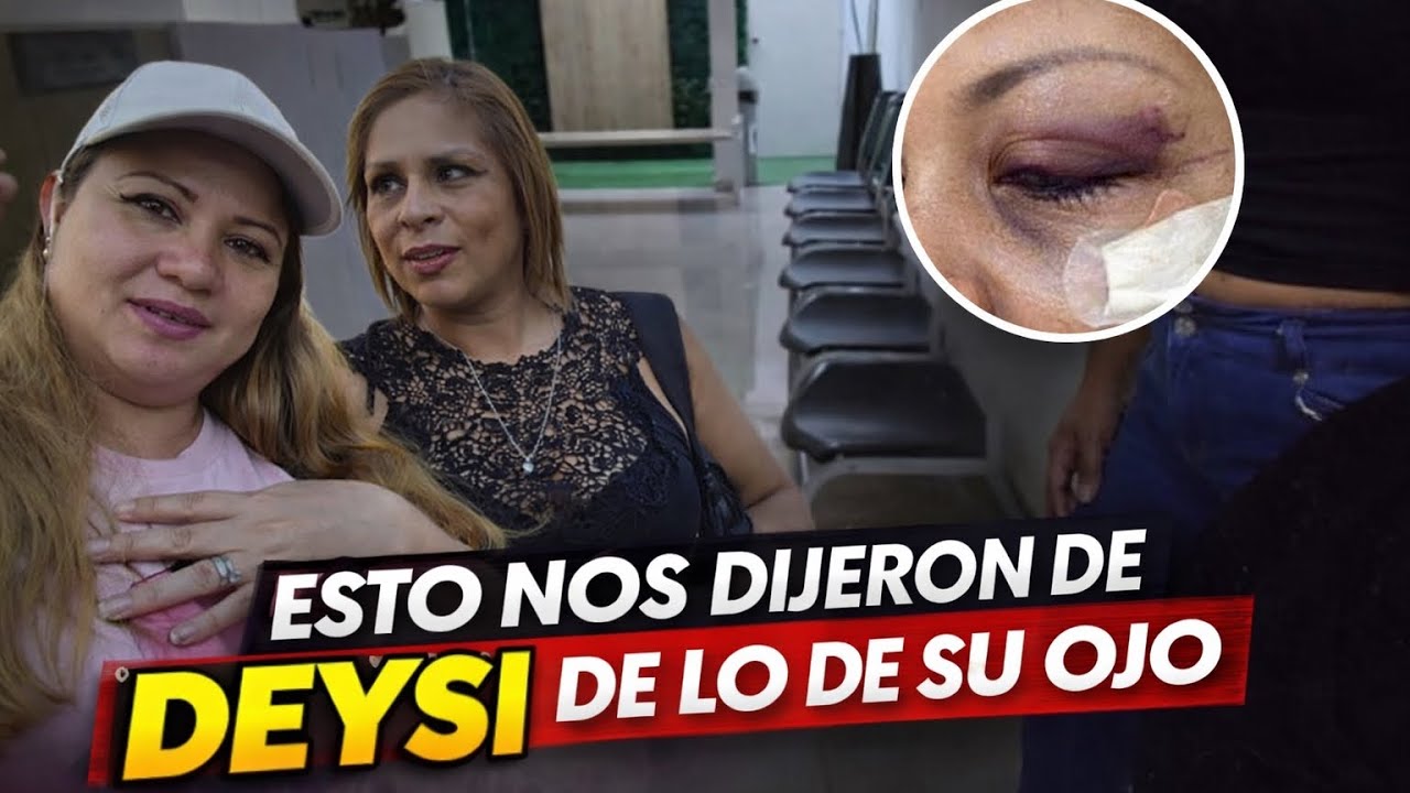 ESTO NOS DIJERÓN PARA EL COSTO $$ PARA EL  CAMBIO DE LA PROTESIS