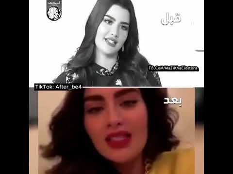 روان حسين تعتذر للسعوديين تناقض تناقضات