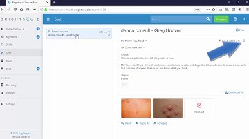 Brightsquid Secure-Mail Tutorial: Message Recall