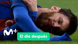 El Día Después (24/04/2017): El Clásico de Messi