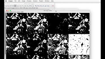 FIJI for Quantification: Auto Threshold