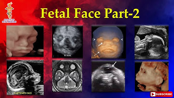 Fetal Face Part-2