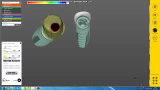 Fastest Exocad Video Tutorial - Custom Abutment Design and Anatomic Crowns