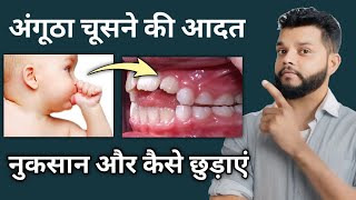 बच्चों मे अंगूठा चूसने की आदत से कैसे छुटकारा पाएं | Thumb Sucking Treatment