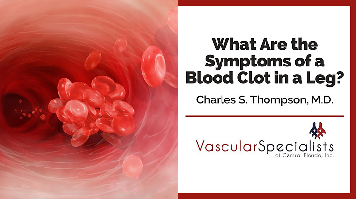 Signs of a blood clot in leg