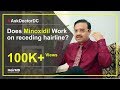 Does Minoxidil Work On Receding Hairline | HairMD, Pune | (In HINDI)