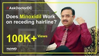 Does Minoxidil Work On Receding Hairline | HairMD, Pune | (In HINDI)