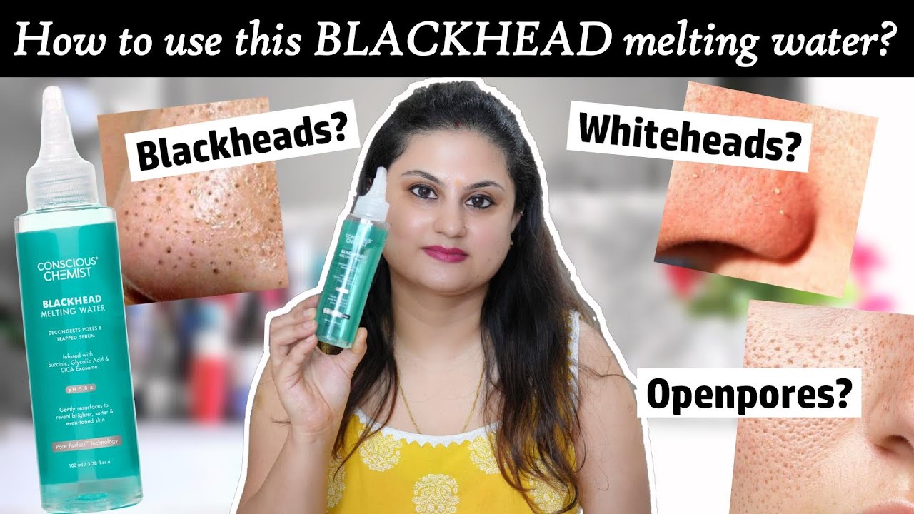 Conscious Chemist Blackhead Melting Water Review | Does It Really Melt😮 Blackheads & Whiteheads??