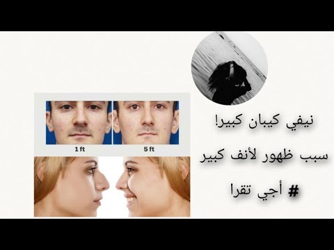 معمرك مسولتي راسك علاش نيفك كبان كبير لأنف