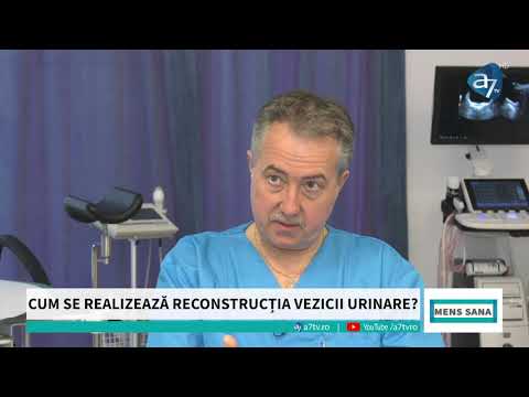 Cum se realizează fațetele dentare? Somnul insuficient favorizează Alzheimerul - Mens Sana