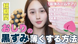 【短期間】お尻の黒ずみを３ヶ月で薄くした方法大公開🍑【ニキビ】