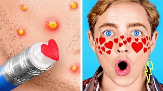 🔥SUPER HACKS Remove thorns and pimples *Cool Gadgets and Hacks for School* #shorts image