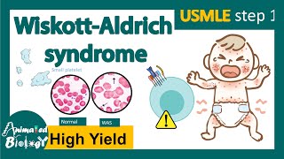 WiskottAldrich syndrome  | WAS | Immunology of WAS | treatment and diagnosis | USMLE step1