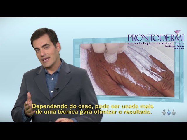 Tratamento REJUVENESCIMENTO DE MÃOS COLO E PESCOÇO