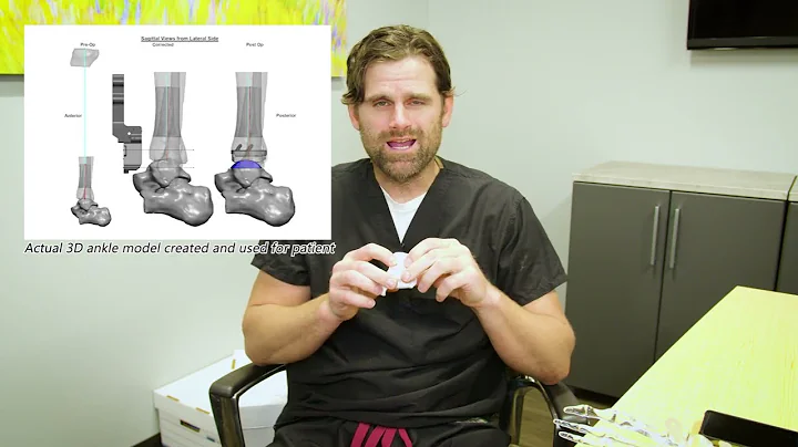 Learn about Total Ankle Replacement with Jason Pat...