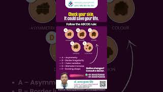Skin Cancer Warning Signs | Learn the ABCDE Rule