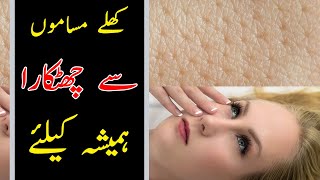 How To remove Large Pores l Best Ways To GET RID of Large Pores screenshot 1