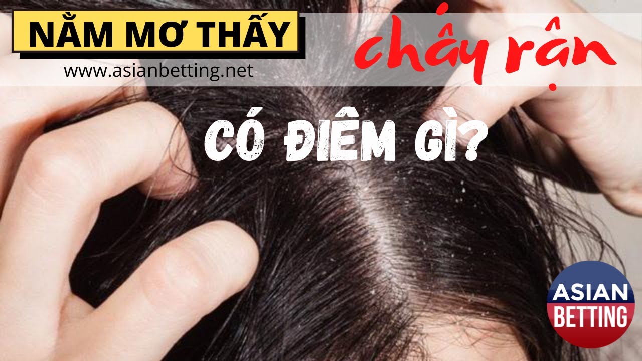 suvip3 Ngủ mơ thấy chấy rận nên đánh số mấy| Asianbetting.net