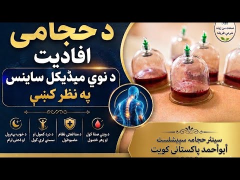 28 May 2026"Hijama Therapy Explained | د Modern Medical Science له نظره د حجامې سائنسي افادیت"
