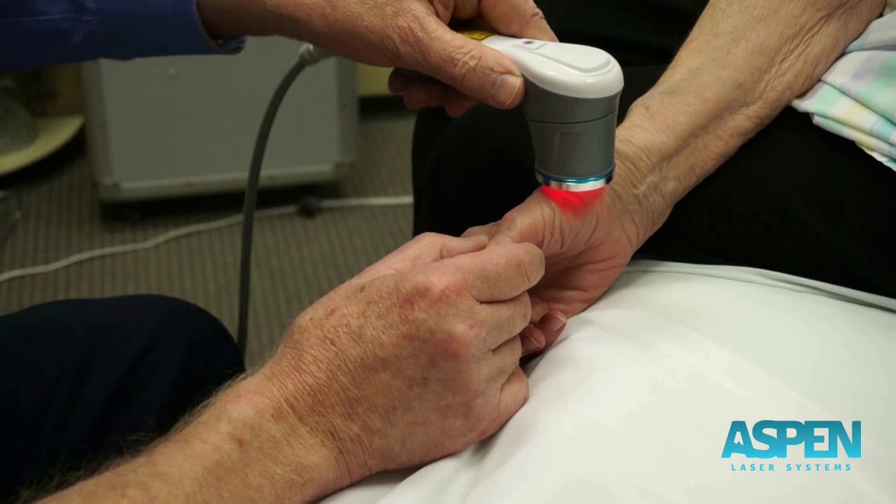 Laser Therapy Treatment for Thumb Arthritis Carpal Tunnel with Class IV Laser