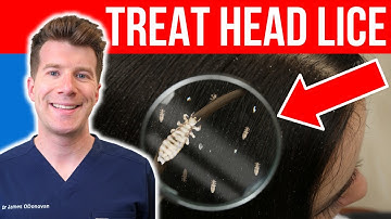 How to TREAT HEAD LICE AND NITS | Doctor