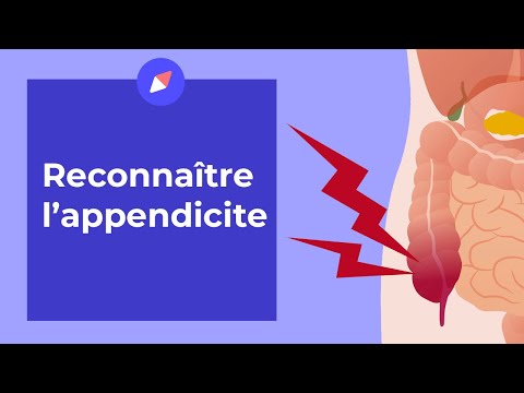 Vidéo: Appendicite - Signes Et Symptômes D'appendicite Aiguë Et Chronique. Où Se Trouve L'appendicite?