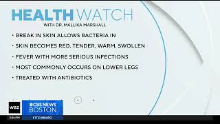 What is cellulitis and how can it be treated?