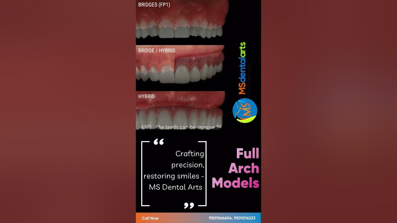 Full Arch Models by MS Dental Arts Lab YouTube