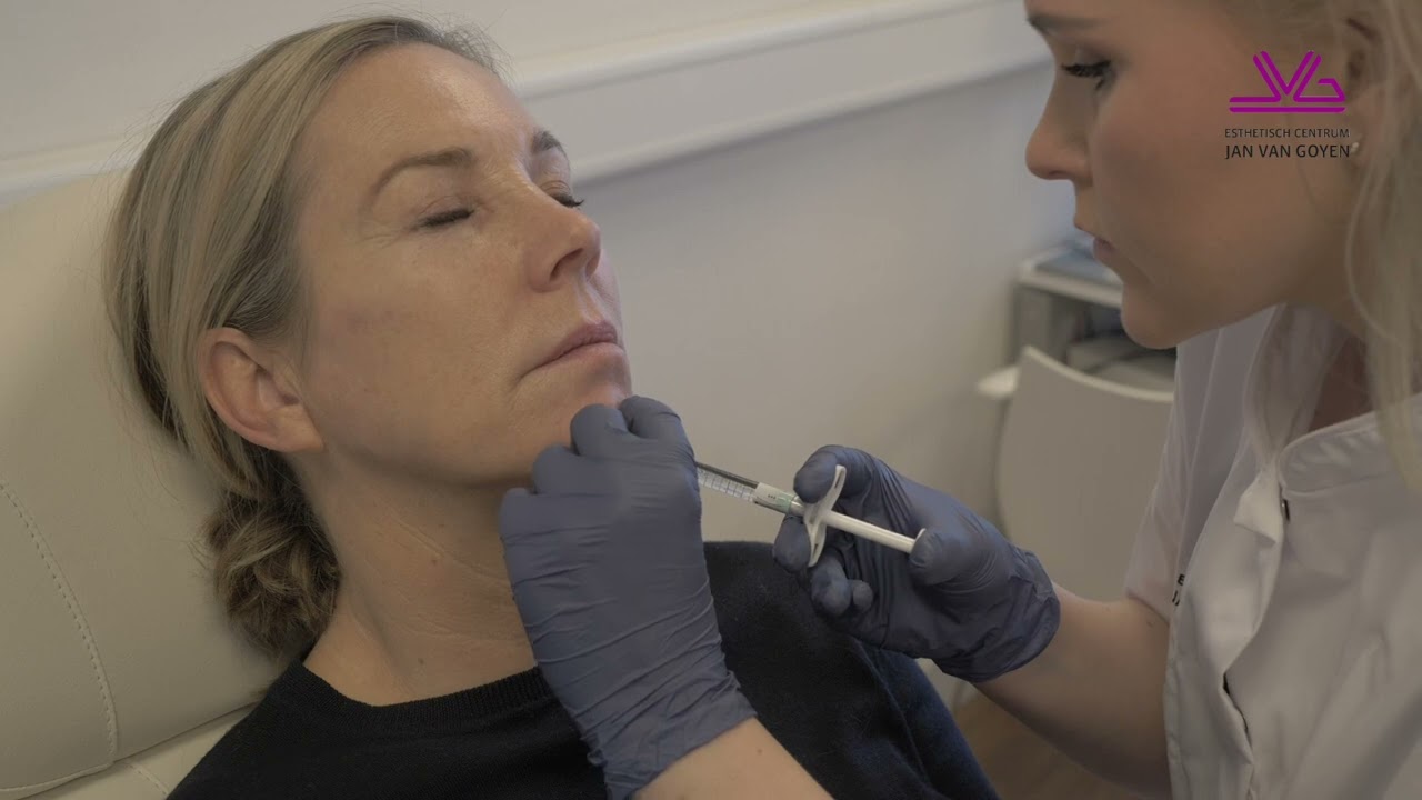 Een strakkere kaaklijn en frissere blik