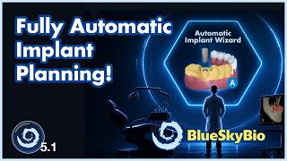 The Future is Here! Fully Automatic Implant Planning and Surgical Guide Design