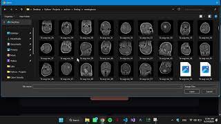 How I Built NeuroMap: An Explainable AI Brain Tumor Detection Web App