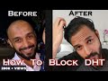 Excess DHT causes HAIR LOSS ? How I Blocked DHT ? Complete Information