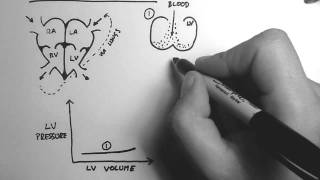 Cardiac Pressure-Volume Loop