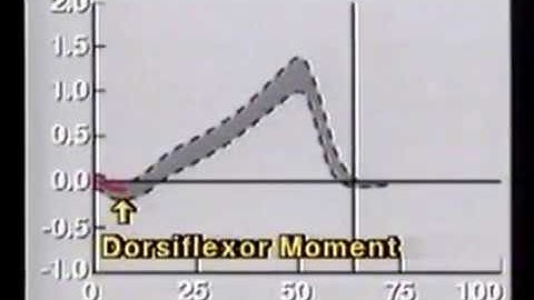 Normal Gait - marcha normal