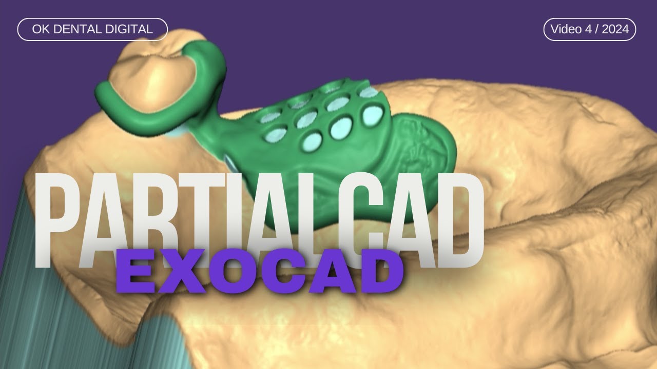 Exocad Partialcad estructura retenedor para protesis total / retainer structure for total prosthesis