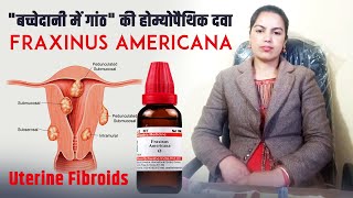 बच्चेदानी में गांठ' की होम्योपैथिक दवा  Fraxinus Americana for uterine fibroid