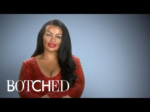 "Botched" Patient Wants Basketball Boobs With Hearts on Front | E!