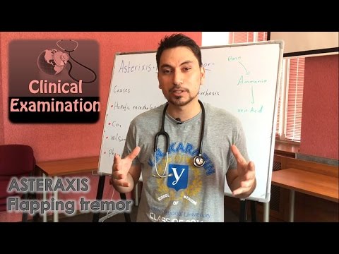 Clinical Examination Asterixis الفحص السريري د.عبدلله مازن
