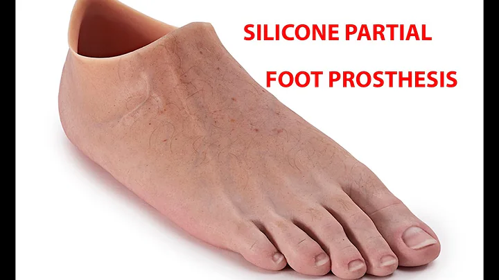 ​Silicone Partial Foot Prosthesis | Prosthetic leg | Prosthetic arm | Cyborgs World