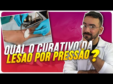 Vídeo: 4 maneiras de tratar escaras