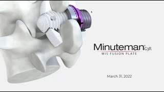 Minuteman Fusion Treatment | Webinar | Pain and Spine Specialists