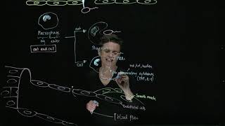 Brandl's Basics: Activation of the Innate Immune System upon bacterial infection Brandl's Basics: Activation of the Innate Immune System upon bacterial infection